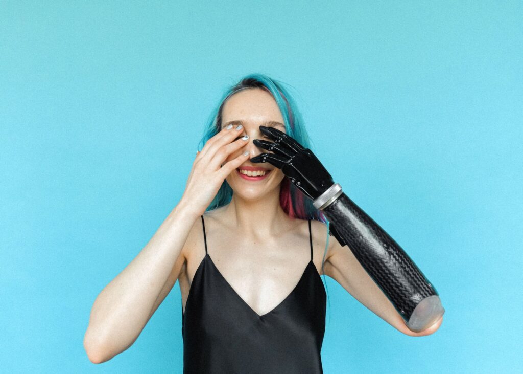 Woman With Prosthetic Arm Smiling And Covering Her Eyes